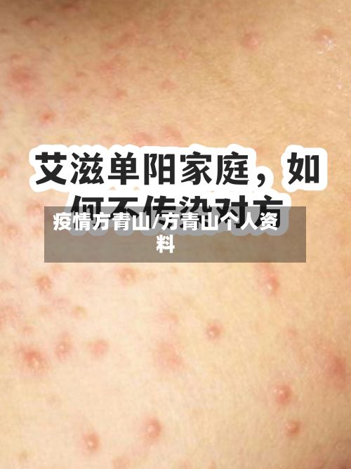 疫情方青山/方青山个人资料