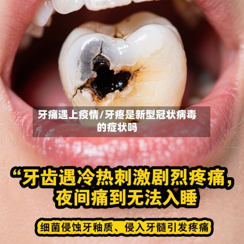 牙痛遇上疫情/牙疼是新型冠状病毒的症状吗-第2张图片